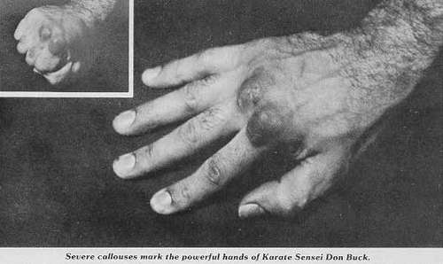 hand of makiwara practitioner